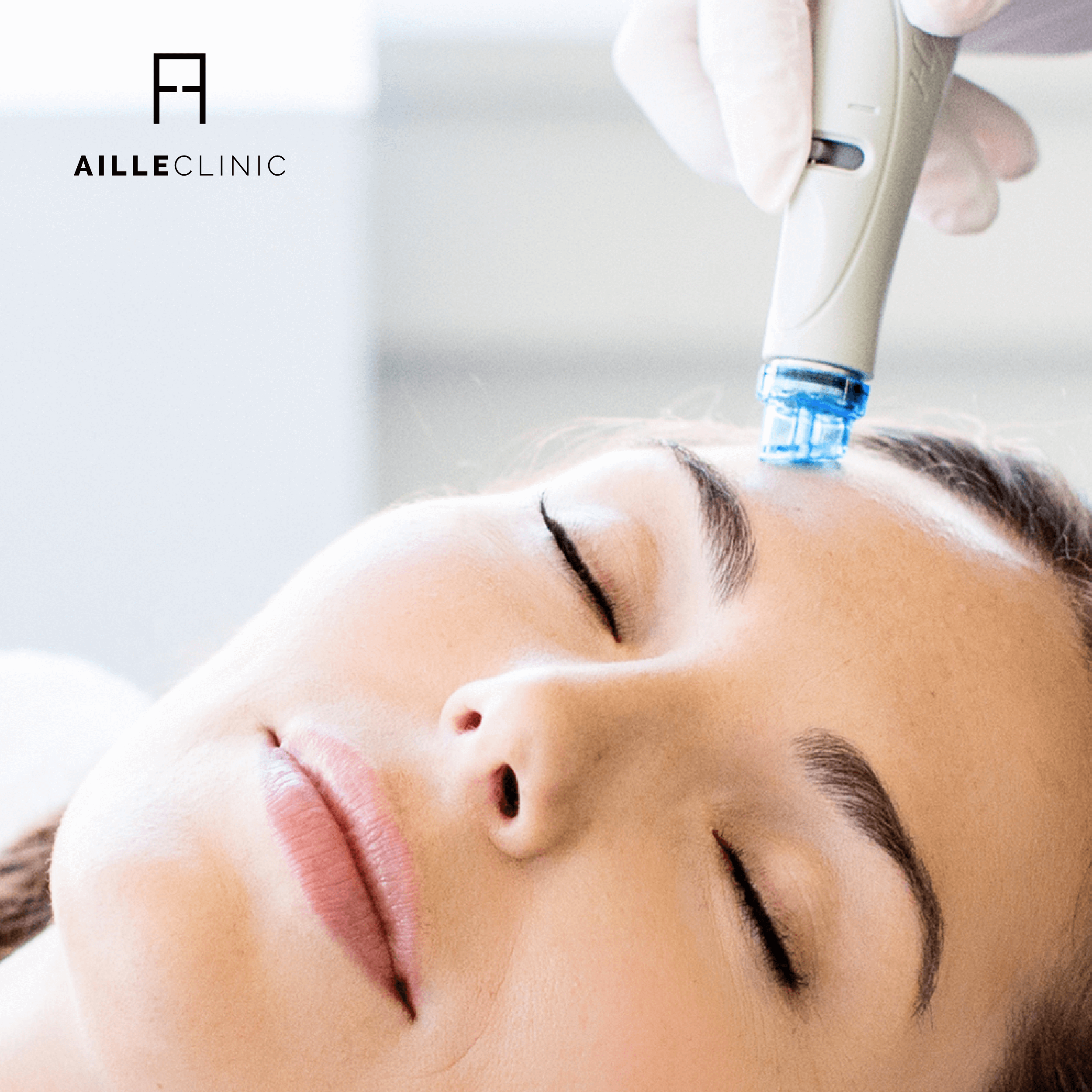 Experiência Hydrafacial