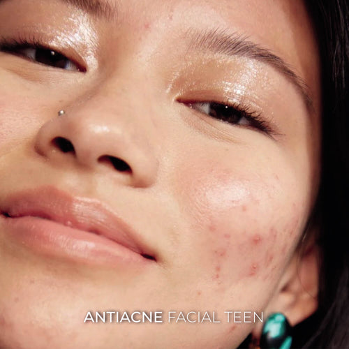 Aille Signature Facials - Antiacne Facial Teen